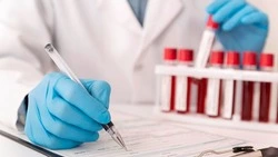 Неделя борьбы со СПИДом и информирования о венерических заболеваниях стартовала в Валуйском округе