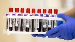 Более 15 тысяч жителей Белгородской области  сдали кровь с начала 2025 года